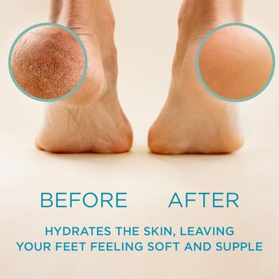 Lee Beauty Professional Callus Remover for Feet - Extra Strength Gel & Rasp Foot File Kit - Original Formula for Dead Skin Remover for Cracked Heels & Dry Skin-Pedicure Supplies for Smooth Foot - 8 Oz