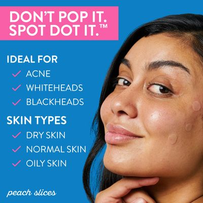 Peach Slices | Acne Spot Dots | Hydrocolloid Acne Patches | For Zits, Blemishes, &amp; Breakouts | Vegan | Cruelty-Free | Pimple Patches | Facial Skin Care Products | 3 Sizes (7mm, 10mm, &amp; 12mm) | 30 Ct