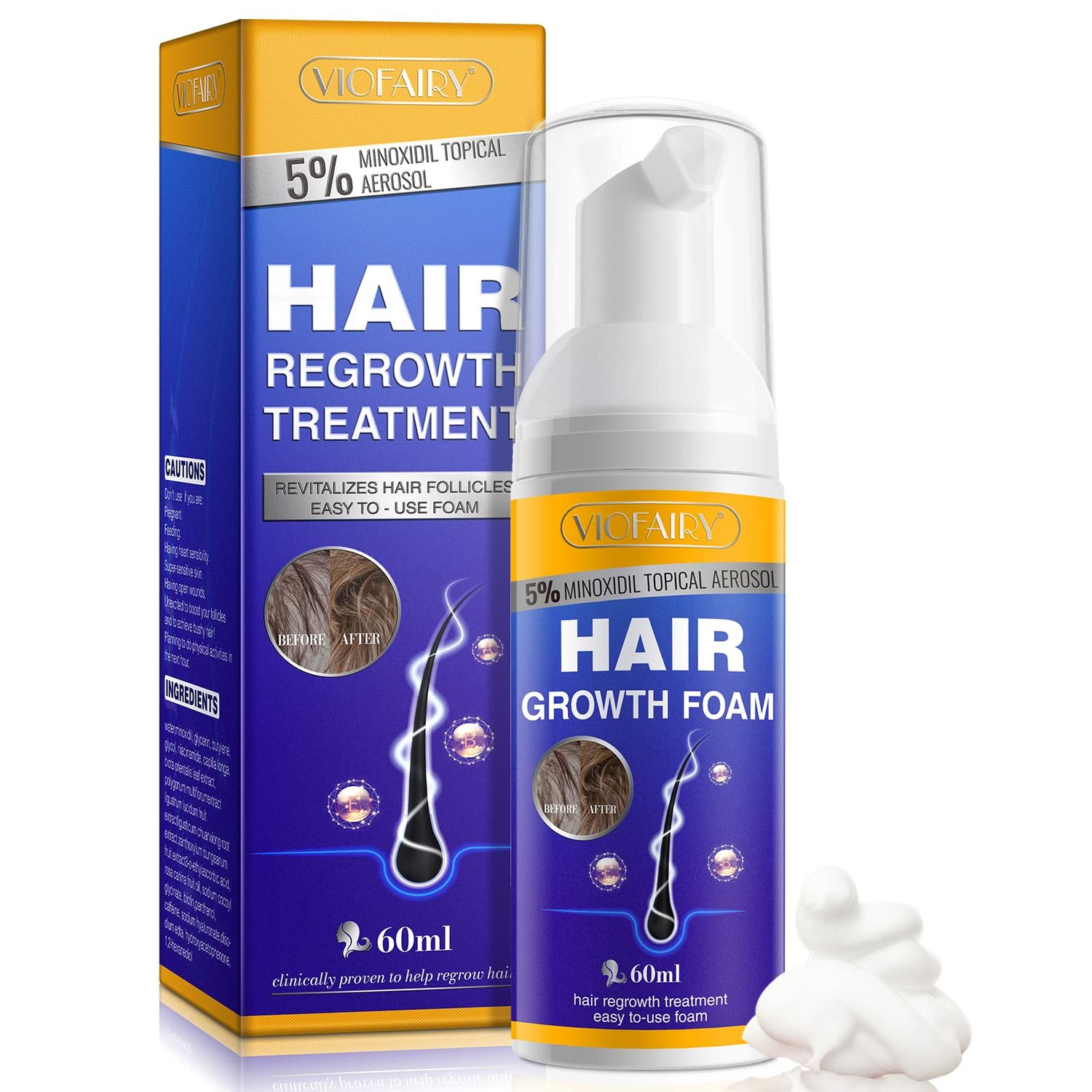 5% Minoxidil Foam for Hair Growth and Thickening - Biotin &amp; Minoxidil Treatment to Stop Thinning &amp; Hair Loss for Men &amp; Women, 2oz