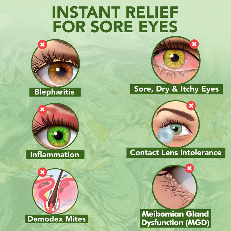 NOVEHA Tea Tree Oil Eyelid &amp; Lash Wipes With Hyaluronic Acid, Green Tea &amp; Chamomile For Blepharitis &amp; Itchy Eyes, Individually Wrapped Eyelash Wipes Natural Makeup Remover &amp; Daily Cleanser (Pack of 3)