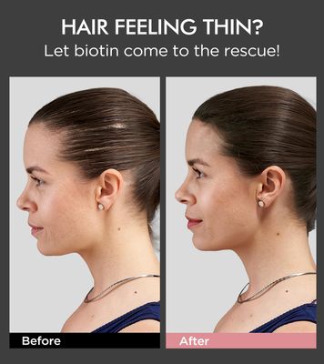 Tripeptide-Infused Hair Growth Biotin Shampoo and Conditioner Set, Onion Anti-Loss Volumizing Moisturizing Treatment for Soft Shine Hair, Rosemary Clarifying Dandruff Shampoo for Women Men, 2 x 16.9oz