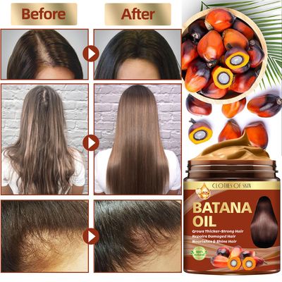 Batana Oil for Hair Growth,Organic Raw Batana Oil Hair Mask & Ginger Hair Growth Oil,Hair Oil Hair Treatment for Frizzy Damaged Hair,For Thicker-Strong Hair,Nourishes Scalp,Repair Dry Damaged Hair