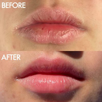 Lanolips 101 Ointment - Lanolin Lip Balm for Smooth, Hydrated & Healthy Lips - Multipurpose Lip Ointment with Lanolin Oil for Dry Lips, Cuticles & More - Coconutter (0.52 oz)