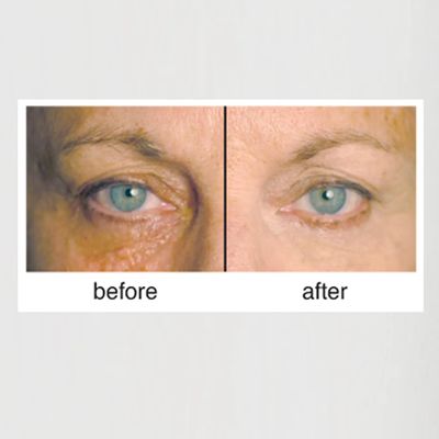 Clientele Peptide Wrinkle Concealer Compact Neutral