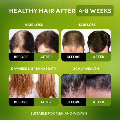 Batana Oil for Hair Growth - 100% Raw &amp; Organic Batana Oil - Cold-Pressed &amp; Pure Unrefined Batana Hair Mask for Women &amp; Men - Enhances Hair Thickness, Prevents Loss, Eliminates Split Ends