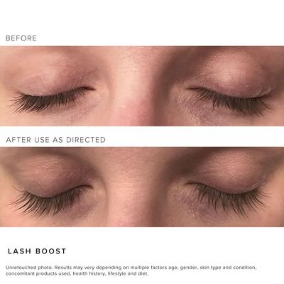 Rodan  Fields RF Lash Boost Serum | 5 ml | Supports Fuller, Longer-Looking Eyelashes &amp; Brows | Easy Nightly Application