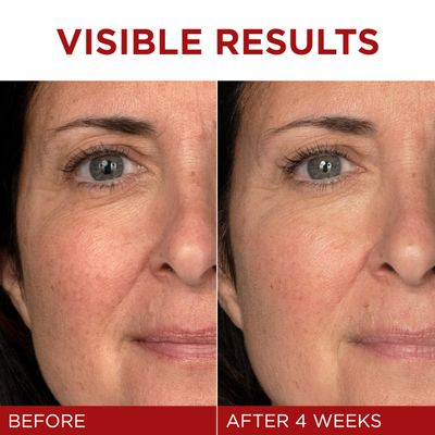 L'Oreal Paris Revitalift Triple Power Anti-Aging Face Moisturizer, Pro Retinol, Hyaluronic Acid &amp; Vitamin C to Reduce Wrinkles, Firm &amp; Brighten Skin, 1.7 Oz