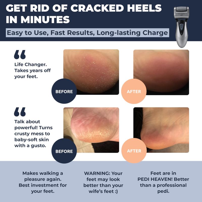 Electric Callus Remover Rechargeable Electronic Foot File CR900 by Own Harmony(Tested Most Powerful) Best Pedicure Tools w 3 Rollers Professional Pedi Feet Care Sander for Cracked Heels and Hard Skin