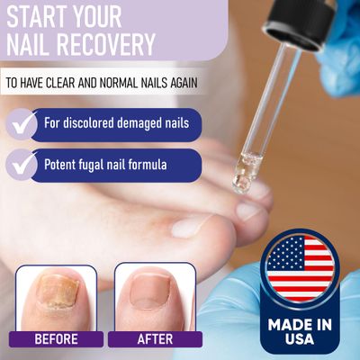 ZanaQuick Extra Strength Toenail &amp; Fingernail Repair Drops - Nail Care Renewal for Thick, Damaged &amp; Discolored Nails - 2 Pack