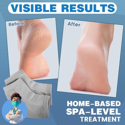 TEAWOO 6 Pairs Moisturizing Heel Socks for Cracked Heel Treatment, Foot Care Toeless Socks to Soften and Hydrate Dry Cracked Feet Heels, Cracked Heel Repair Socks, Gel Socks for Dry Cracked Feet