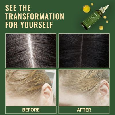 Fadelo Batana Oil - Dr Sebi Organic Oil for Hair Growth, 100% Raw Pure Natural from Honduras, Deeply Nourishing Scalp for Thicker & Stronger Hair, 4.05 fl oz