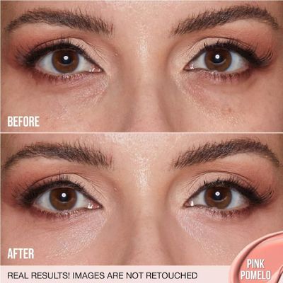 H.U.D.A BEAUTY #FAUXFILTER Under Eye Color Corrector Pink Pomelo (0.3 oz  9 mL)  Bonus Acne Patch (36 Pieces)