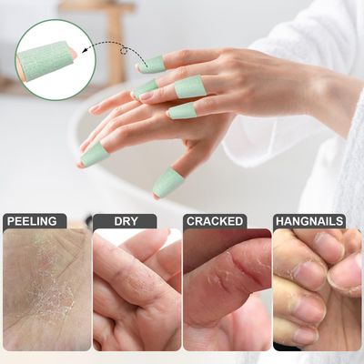 TEAWOO 50PCS Aloe Vera Cracked Hands Treatment Patches, Dry Cracked Hands Repair Bandage