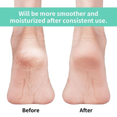 Vaincre Cracked Heel Repair Socks - 4 Pairs Moisturizing Heel Socks for Dry Cracked Feet, Gel Socks for Cracked Feet Heel Treatment, Spa Moisture Cracked Heel Socks for Dry Heels Overnight (Regular)