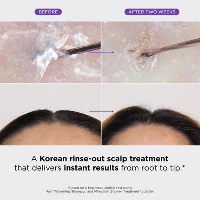 Dr. Groot Miracle in Shower Treatment for Hair Loss, Korean Hair Care, 5 Seconds to Smooth Hair, Rosemary Oil for Healthier-Looking Hair, Hair Rinse, Moisturizing Treatment,Scalp Revitalizing Solution