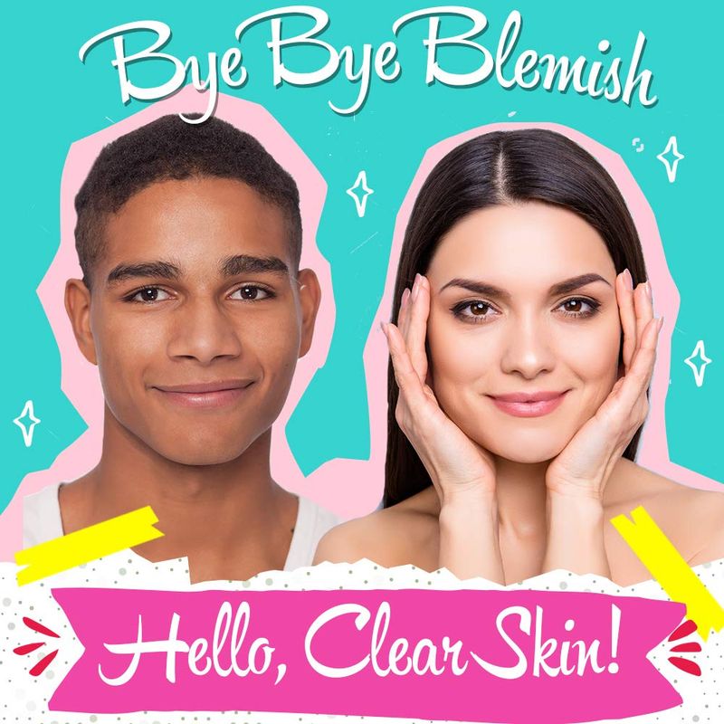 Bye Bye Blemish Acne Drying Lotion, Reduce Pimples Overnight 1oz, 1-Pack