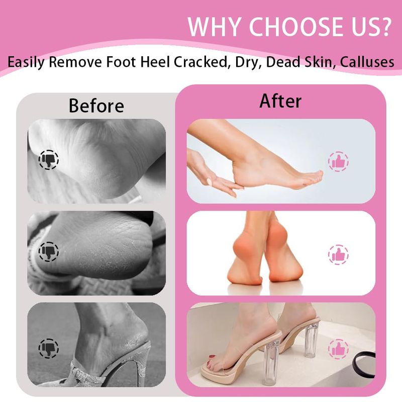 Electric Foot Callus Remover,MOWLIE Electric Foot Care Tools with Speed Controller and 60pcs Replacement Sandpaper Disk for Men Women Dead Dry Crack Skin Calluses (pink-11)