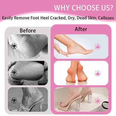 Electric Foot Callus Remover,MOWLIE Electric Foot Care Tools with Speed Controller and 60pcs Replacement Sandpaper Disk for Men Women Dead Dry Crack Skin Calluses (pink-11)