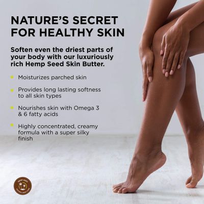 Hemp Seed Skin Butter, Nag Champa - 8 oz. - Total Body Moisturizer - Hemp Seed Oil, Jojoba Oil, Shea Butter - Vegan &amp; Cruelty Free