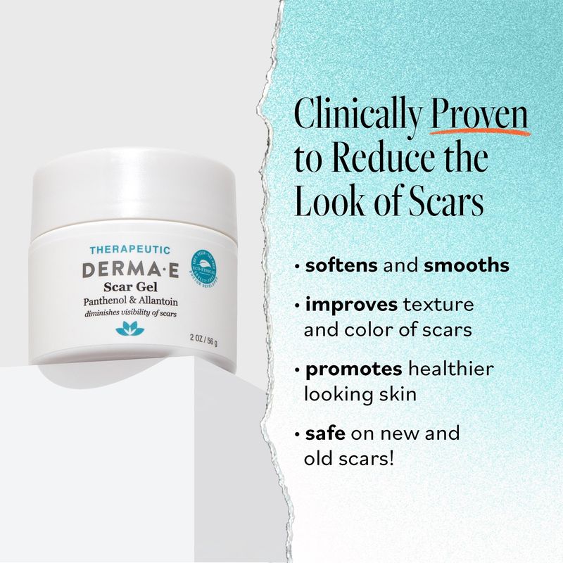 Derma E Scar Gel - Scar Treatment for Face - Hydrating Gel for Acne Scars, Burns &amp; Stretch Marks with Panthenol &amp; Allantoin, 2 oz
