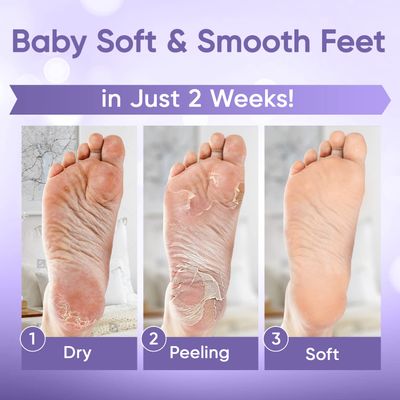 Foot Peeling Mask | Skin Care Pedicure Foot spa - Foot Mask &amp; Foot Callus Remover with Aloe Vera Extract for Baby Soft Skin | Woman &amp; Man | Remove Dead Skin, Cracked Feet &amp; Callus | Lavender (2 Pairs)