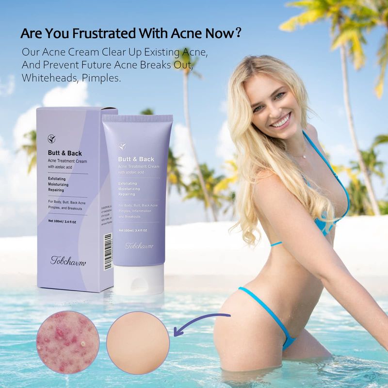 Butt Acne Clearing Treatment, Maximum Strength Body Cream for Back, Buttocks, Thigh &amp; Chest Acne Removal, Skin Clearing Lotion for Men &amp; Women, Foaming Cleanser for Bacne &amp; Cystic Acne