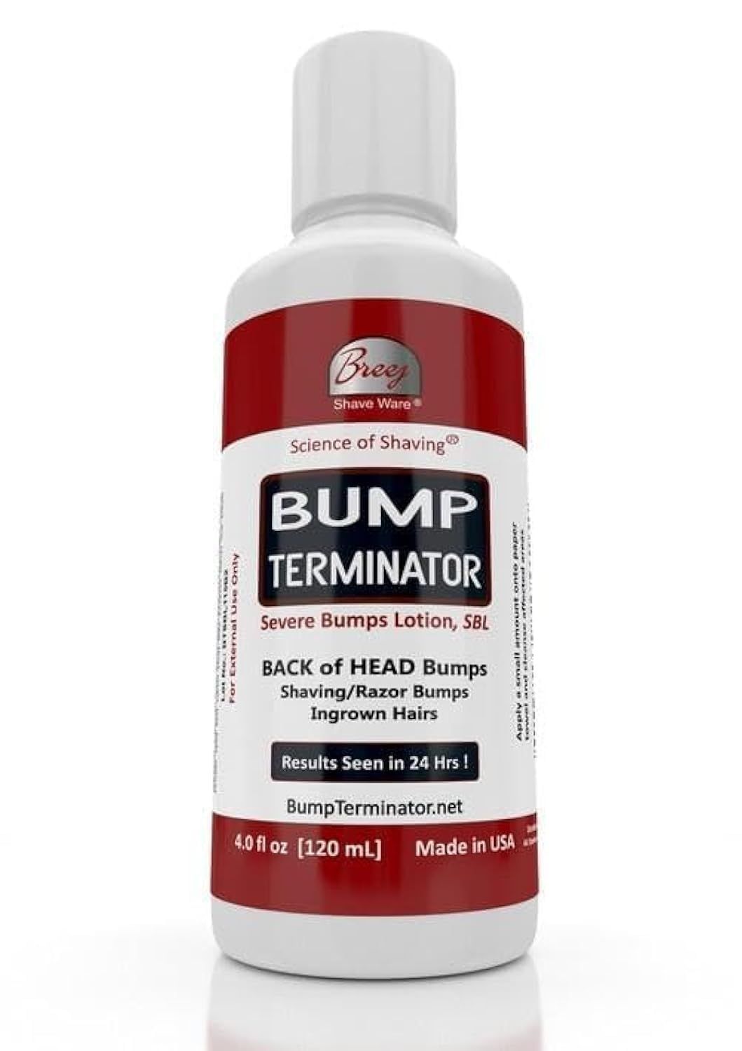 BUMP TERMINATOR Severe Bumps Treatment | Razor Bumps And Ingrown Hair Treatment | Bikini Bumps | Back of Head Bumps And Ingrown Hair Treatment, 4 oz (Pack of 1)
