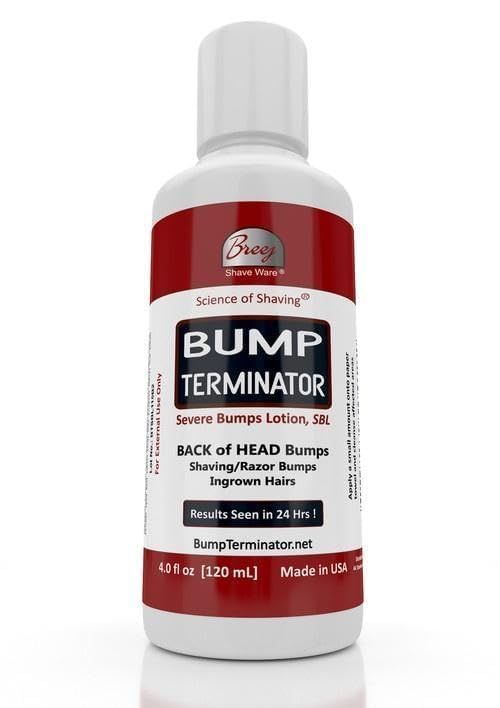 BUMP TERMINATOR Severe Bumps Treatment | Razor Bumps And Ingrown Hair Treatment | Bikini Bumps | Back of Head Bumps And Ingrown Hair Treatment, 4 oz (Pack of 1)