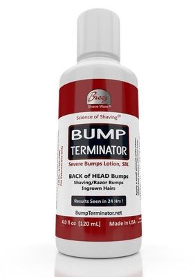 BUMP TERMINATOR Severe Bumps Treatment | Razor Bumps And Ingrown Hair Treatment | Bikini Bumps | Back of Head Bumps And Ingrown Hair Treatment, 4 oz (Pack of 1)