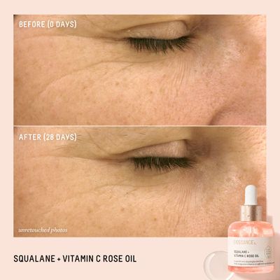 Biossance Squalane + Vitamin C Rose Oil, Advanced Facial Oil - Brightening, Firming, and Hydrating Serum for All Skin Types - Chios Crystal Oil, Damascus Rose Extract &amp; Squalane for Radiance - 1oz