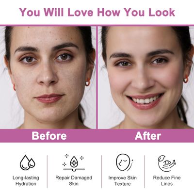 Christmas Gifts for Women,Skin Care Set,Anti-Aging Moisturizing Repair Soothing Snail Mucin Serum Facial Skin Care Routine Kit for Sensitive Dull Skin & Fine Lines,Skincare Gift Set Teenage Teen Girl