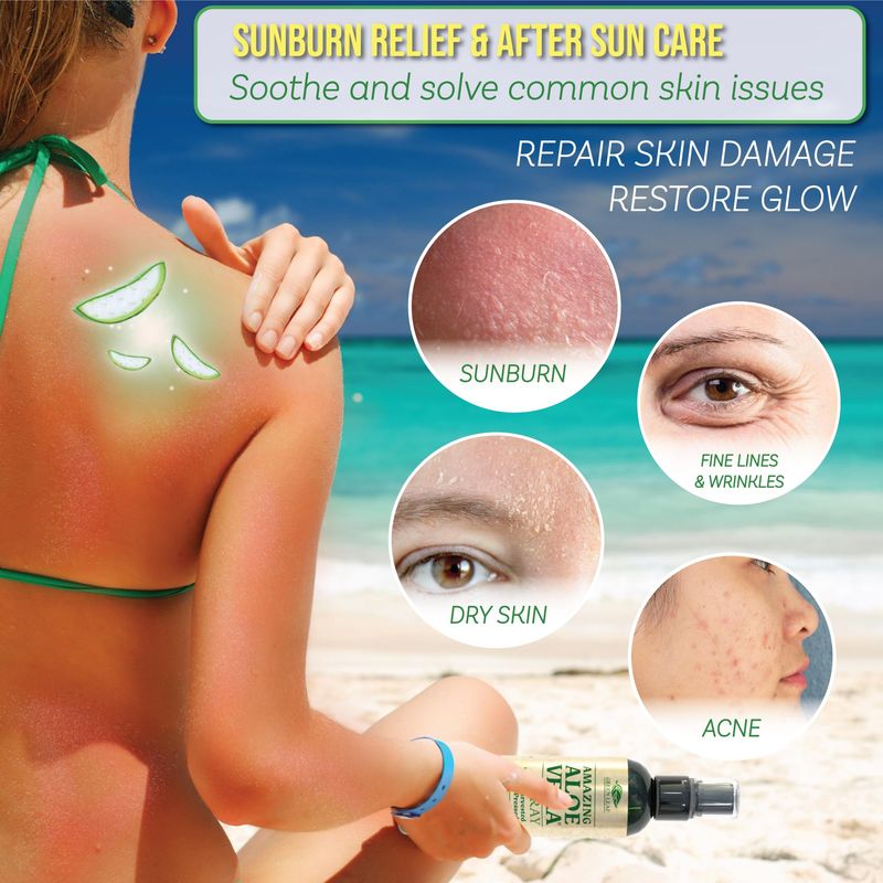 Green Leaf Aloe Vera Spray 99% Pure Cold-Pressed Aloe Vera Juice, for Hair, Skin &amp; Face Moisturizer, Fast Absorption After Sun Care, Sunburn Relief &amp; Solar Recovery Spray| 12oz |Aloevera Body Spray