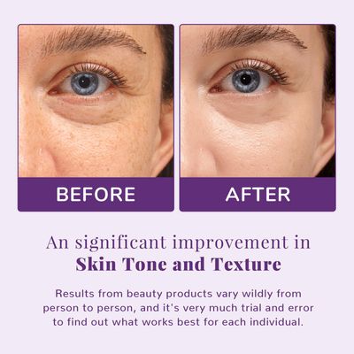 ANAI RUI Niacinamide Toner Pads,with Glutathione, Niacinamide, LHA, PHA, Facial Radiance Pads, Skin Care Pads for Even Skin Tone, Reduce Blemish and Spots 50 Pads