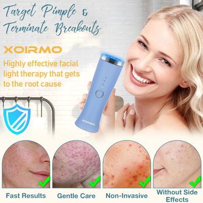 Blue Light Therapy Device for Acne Spot Treatment - XOIRMO LED Acne Blue Light Therapy Wand for Face