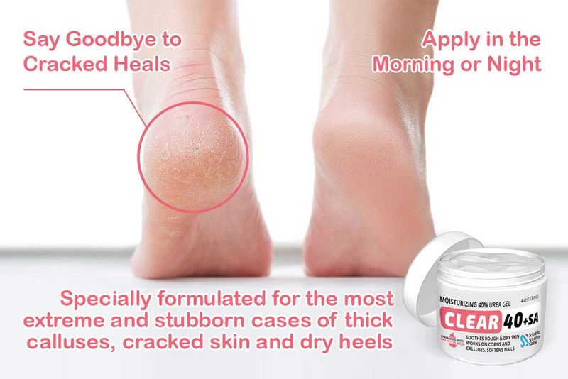 CLEAR Urea Cream 40 Percent Plus 2% Salicylic Acid (4oz) Made in USA | Urea Foot &amp; Hand Cream Softens Cracked Heels &amp; Dry Skin with Tea Tree &amp; Coconut Oil - Callus &amp; Corn Treatment