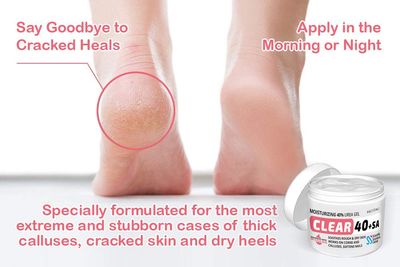 CLEAR Urea Cream 40 Percent Plus 2% Salicylic Acid (4oz) Made in USA | Urea Foot & Hand Cream Softens Cracked Heels & Dry Skin with Tea Tree & Coconut Oil - Callus & Corn Treatment