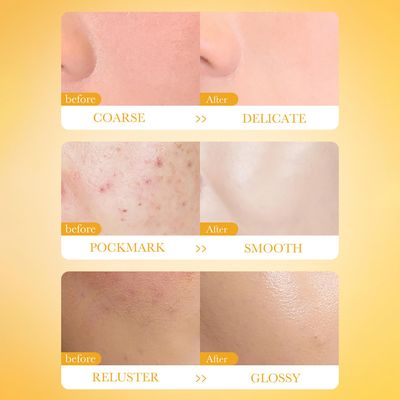 BIOAQUA Vitamin C Mud Facial Mask Sweet Orange Moisturizing Clean Pores Oil Control Face Skin Refreshing 8gx 10pcs