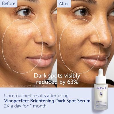 Caudalie Vinoperfect Brightening Dark Spot Serum, Dark Spot Corrector 62x More Effective than Vitamin C, Skin Brightening Serum with Viniferine, 1 Fl Oz