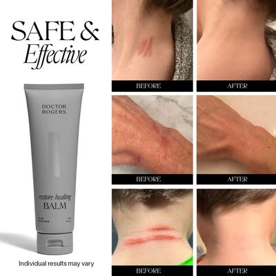 Doctor Rogers Restore Healing Balm | Multi-Purpose Healing Ointment &amp; Moisturizing Eczema Relief Gel | Protects &amp; Soothes Injured, Sensitive &amp; Dry Skin | 4 oz Tube