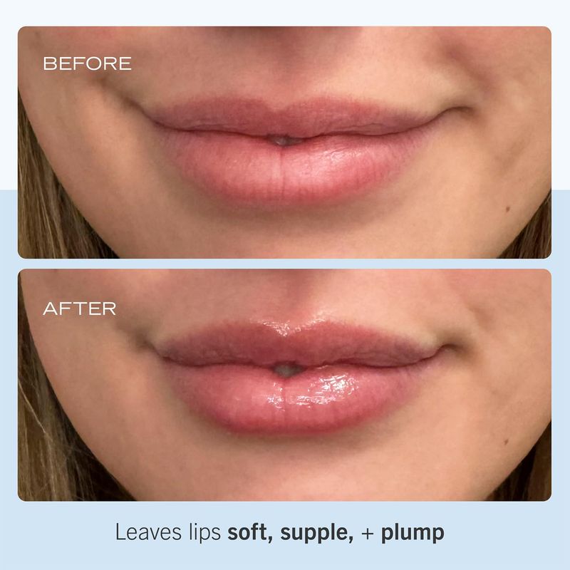 First Aid Beauty - Ultra Repair Lip Balm, Instant Hydration and Moisture for Soft, Supple &amp; Plump Lips, Concentrated Formula of Botanical Oils, Butters &amp; Waxes, Cruelty Free, 0.25 oz