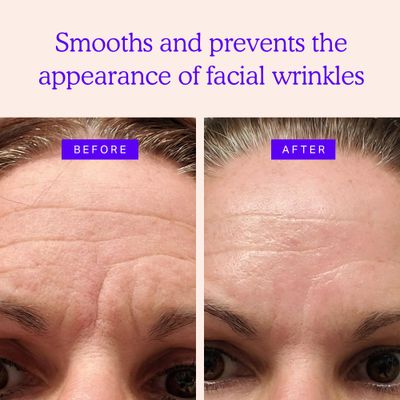 BLUMBODY Face & Forehead Wrinkle Patches - Mini Anti Wrinkle Facial Patches to Smooth Eye, Mouth, Forehead Wrinkles - Non-Silicone Face Tape for Fine Wrinkles between Eyes & Face - 160 Face Patches