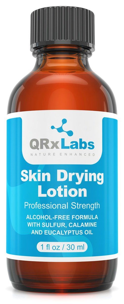 Drying Lotion - Alcohol-Free Overnight Acne &amp; Whitehead Spot Treatment - Fights Blemishes, Pimples &amp; Breakouts for a Clear Skin - Fast Acting Formula with Sulfur &amp; Salicylic Acid - 1 fl oz