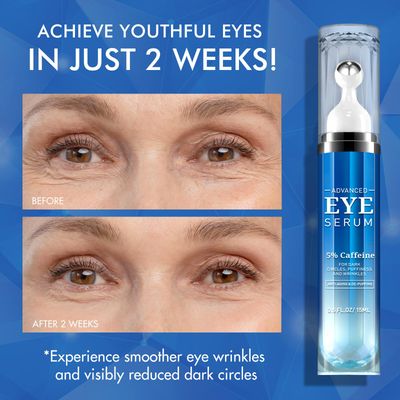 5% Caffeine Eye Cream Under Eye Serum for Women, Eye Serum for Dark Circles Puffiness Eye Bags Fine Lines Wrinkles with 360 Eye Roller Massage Ball, Morning Night Skin Care, 0.5 Fl Oz