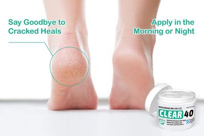 CLEAR 40 Urea Cream 40 Percent for Feet Maximum Strength (4oz) | Softens Cracked Heels & Dry Skin Urea Cream 40 Percent - Tea Tree & Coconut Oil | Urea Cream for Callus & Corn Treatment | Made in USA