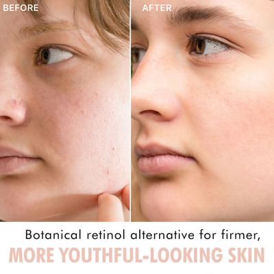 Bakuchiol Face Serum - USA Made with Natural &amp; Organic Ingredients, Plant Based Retinol Alternative for Sensitive Skin, Smoothes Wrinkles &amp; Fine Lines, Anti Aging Serum for Face, Skin Care Serum
