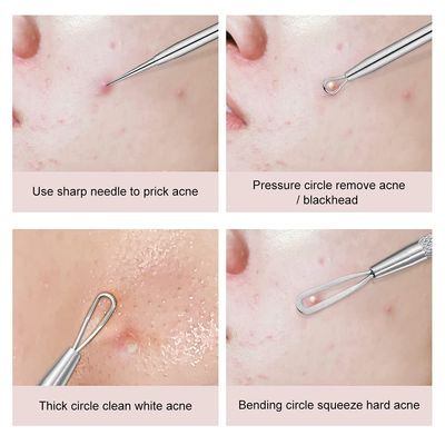 Blackhead Remover, 2 PCS Pimple Popper Stainless Steel Pimple Extractor Blackhead Removal Tool Risk Free Treatment for Blemish,Whitehead Popping