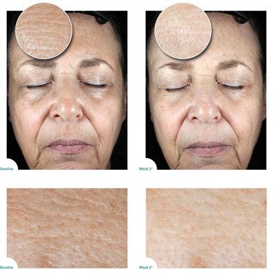 Aquareveal Satin Bright Soft Water Peel for Face , exfoliator for anti-aging, acne, dry, oily, sensitive skin, eczema , 95% organic/natural Korean peeling gel/gommage , large 100 ml/3.4 Fl Oz size