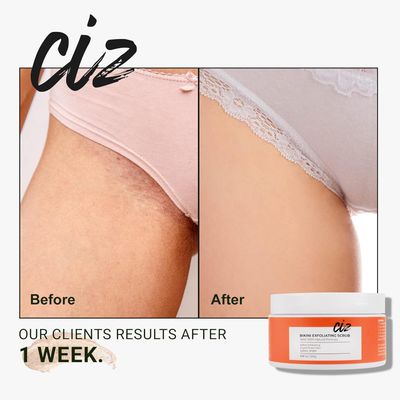 Bikini Area Exfoliator, Exfoliating Scrub for Bikini Area, Ingrown Hair Treatment for Bikini Area, Razor Bump Treatment for Bikini Area, Sugar Scrub for Bikini Area, Shaving Exfoliator Scrub for Women