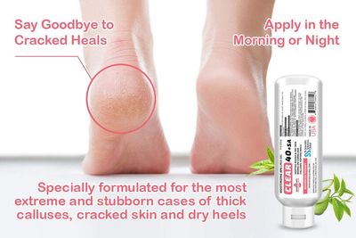 CLEAR Urea Cream 40% +2% Salicylic Acid (8oz) | Softens Cracked Heels &amp; Dry Skin Urea Salicylic Acid Cream- Tea Tree &amp; Coconut Oil | Salicylic Acid Foot Cream for Callus &amp; Corn Treatment | Made in USA