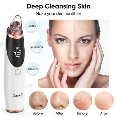 Daweir Blackhead Remover Pore Vacuum - Pimple Extractor Tools Pore Cleaner toolfor Face &amp; Nose